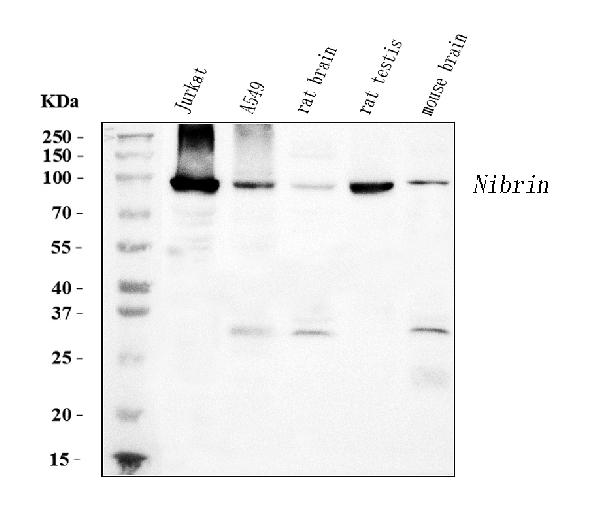 1 - Anti-p95 NBS1 Antibody Picoband™ (monoclonal, 5D7A1) ABO15096