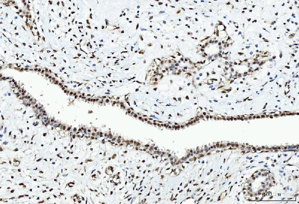 2 - Anti-CTBP2 Antibody Picoband™ (monoclonal, 10E9D2) ABO15097
