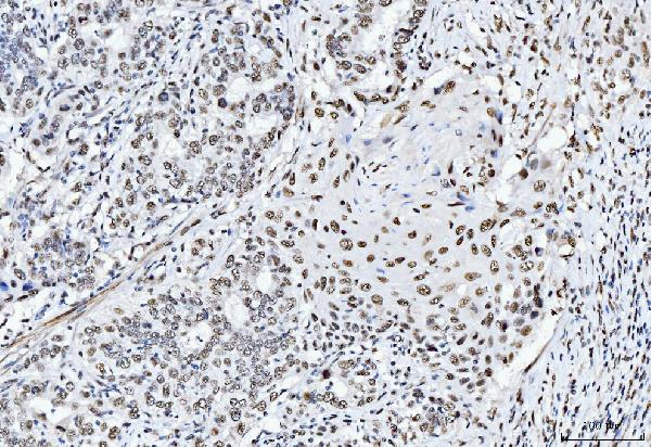 2 - Anti-CTBP2 Antibody Picoband™ (monoclonal, 10E9D2) ABO15097