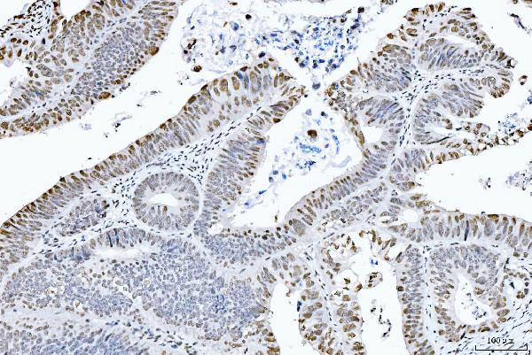 2 - Anti-CTBP2 Antibody Picoband™ (monoclonal, 10E9D2) ABO15097