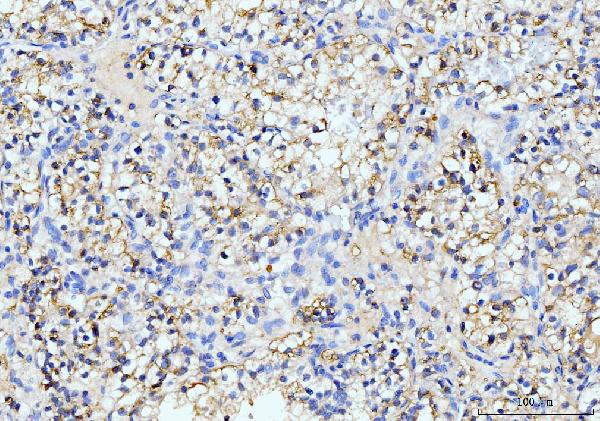 2 - Anti-ITCH/AIP4 Antibody Picoband™ (monoclonal, 5E12) ABO15099