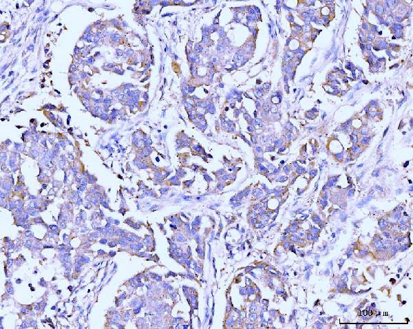 2 - Anti-ITCH/AIP4 Antibody Picoband™ (monoclonal, 5E12) ABO15099