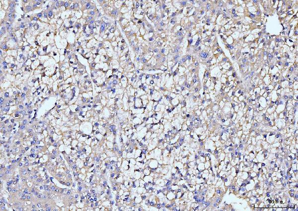 2 - Anti-ITCH/AIP4 Antibody Picoband™ (monoclonal, 5E12) ABO15099