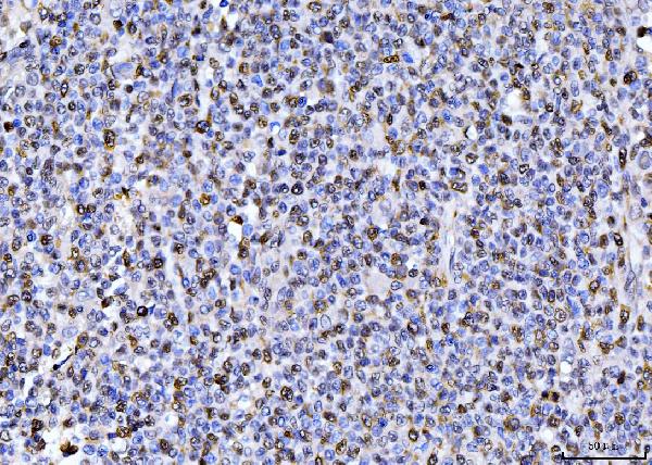 2 - Anti-PCNA Antibody Picoband™ (monoclonal, 2G2) ABO15100