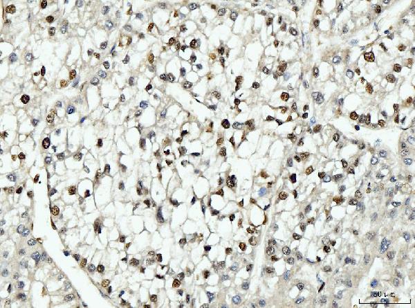 2 - Anti-PCNA Antibody Picoband™ (monoclonal, 2G2) ABO15100