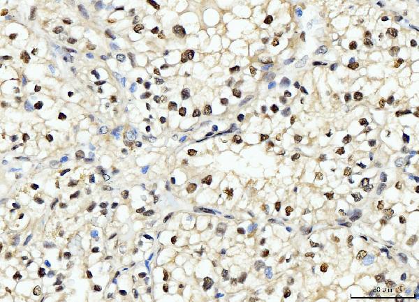 2 - Anti-PCNA Antibody Picoband™ (monoclonal, 2G2) ABO15100