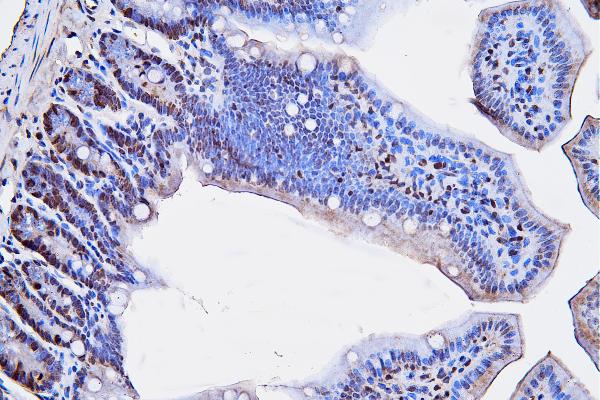 2 - Anti-PCNA Antibody Picoband™ (monoclonal, 2G2) ABO15100