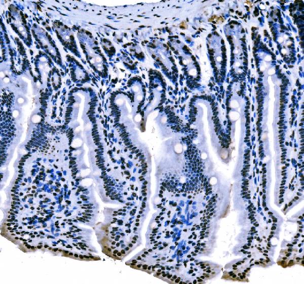 2 - Anti-splicing factor 1 Antibody Picoband™ (monoclonal, 2F5D10) ABO15102