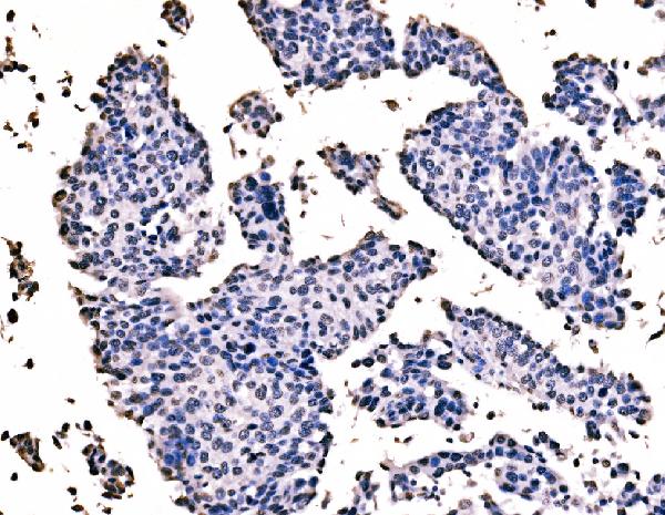 2 - Anti-splicing factor 1 Antibody Picoband™ (monoclonal, 7D9E3) ABO15101