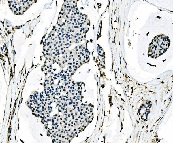 2 - Anti-splicing factor 1 Antibody Picoband™ (monoclonal, 7D9E3) ABO15101