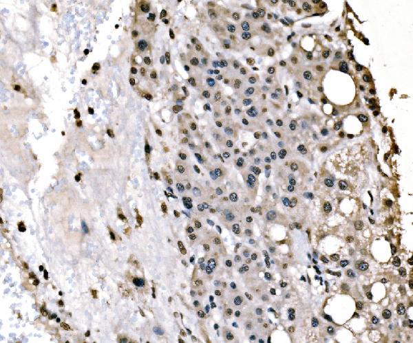 2 - Anti-splicing factor 1 Antibody Picoband™ (monoclonal, 7D9E3) ABO15101