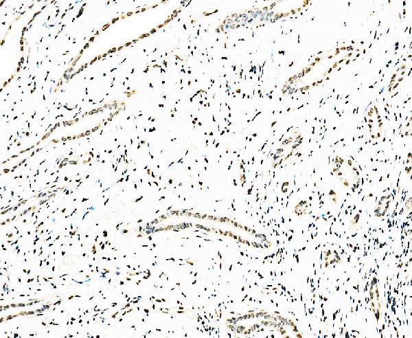 2 - Anti-splicing factor 1 Antibody Picoband™ (monoclonal, 7D9E3) ABO15101
