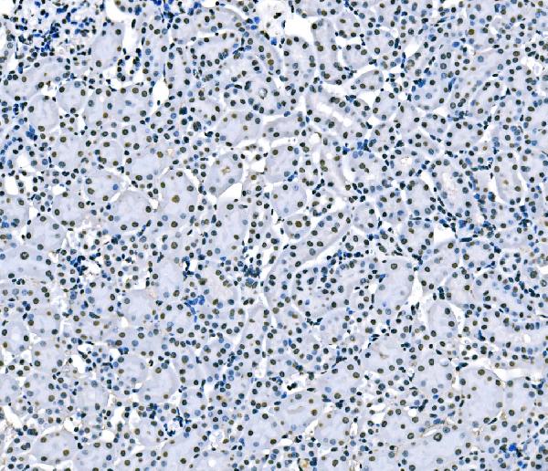 2 - Anti-splicing factor 1 Antibody Picoband™ (monoclonal, 2F5D10) ABO15102