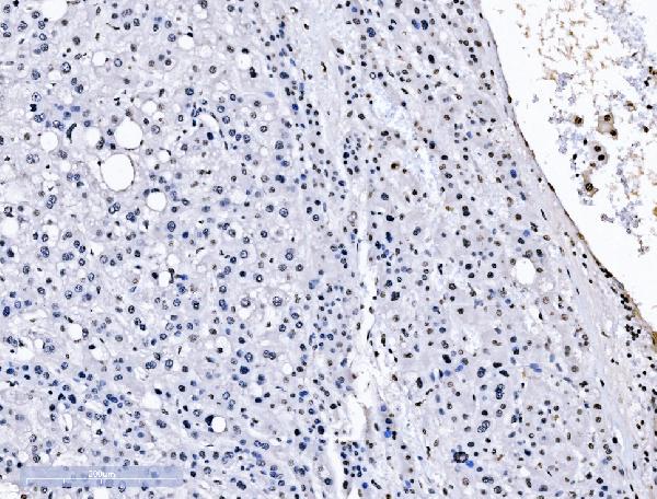 2 - Anti-splicing factor 1 Antibody Picoband™ (monoclonal, 2F5D10) ABO15102