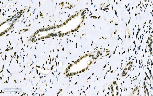 2 - Anti-splicing factor 1 Antibody Picoband™ (monoclonal, 2F5D10) ABO15102