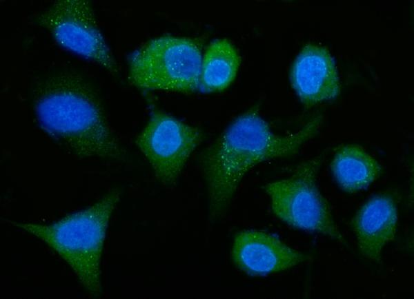 3 - Anti-ALDH1A1 Antibody Picoband™ (monoclonal, 4C3) ABO15104