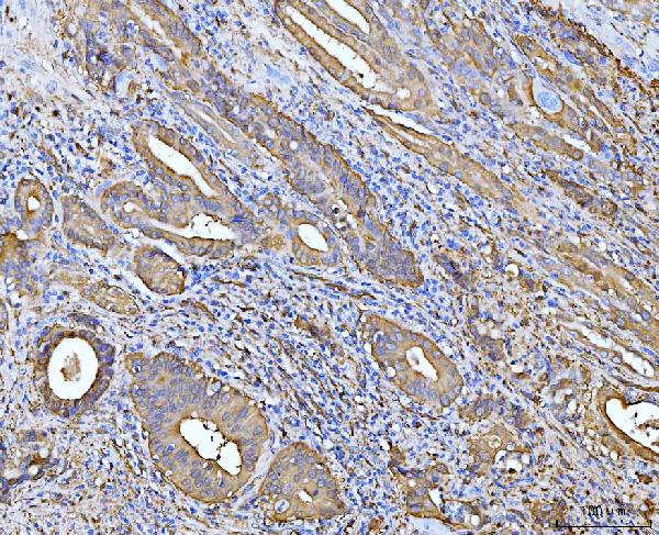 2 - Anti-ALDH1A1 Antibody Picoband™ (monoclonal, 4C3) ABO15104