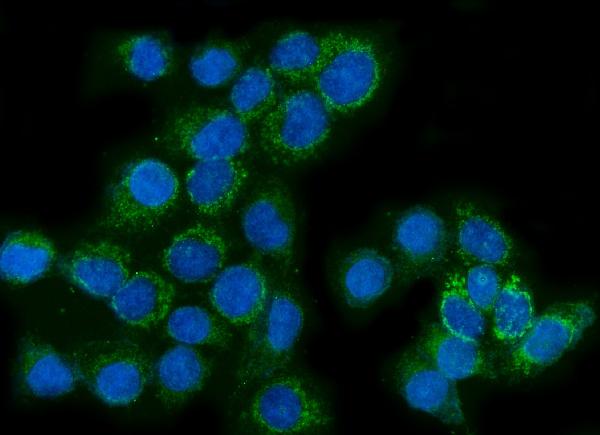3 - Anti-Glutaminase/GLS Antibody Picoband™ (monoclonal, 9G6) ABO15105