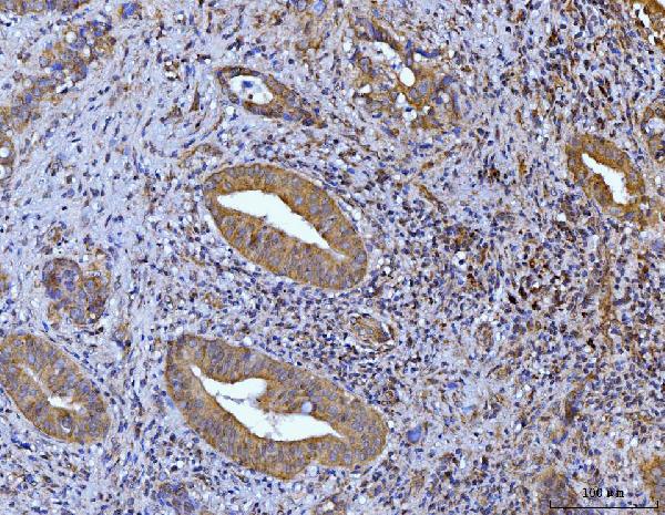 2 - Anti-Glutaminase/GLS Antibody Picoband™ (monoclonal, 9G6) ABO15105