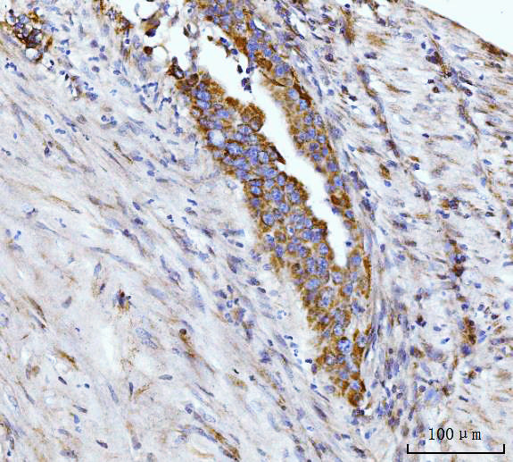 2 - Anti-Glutaminase/GLS Antibody Picoband™ (monoclonal, 9G6) ABO15105