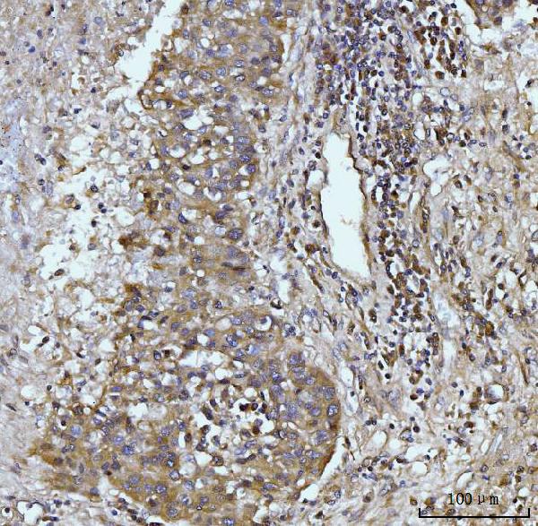 2 - Anti-Glutaminase/GLS Antibody Picoband™ (monoclonal, 9G6) ABO15105
