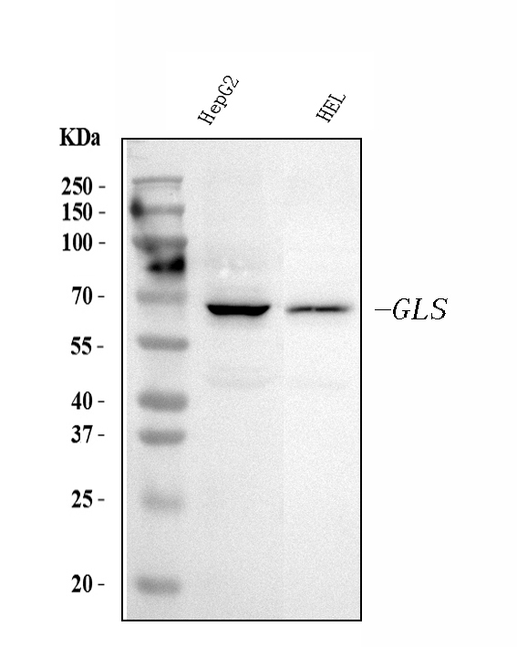 1 - Anti-Glutaminase/GLS Antibody Picoband™ (monoclonal, 9G6) ABO15105