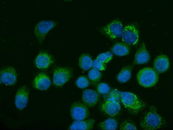 3 - Anti-Glutaminase/GLS Antibody Picoband™ (monoclonal, 3G13) ABO15106