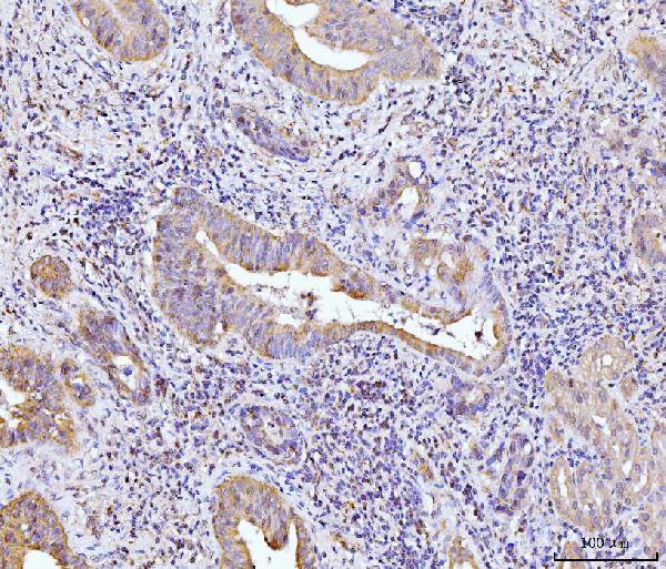 2 - Anti-Glutaminase/GLS Antibody Picoband™ (monoclonal, 3G13) ABO15106