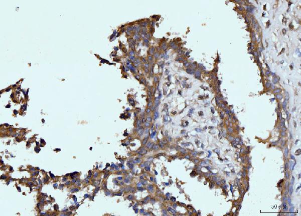 2 - Anti-Glutaminase/GLS Antibody Picoband™ (monoclonal, 3G13) ABO15106