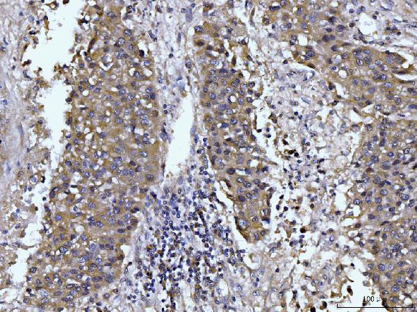 2 - Anti-Glutaminase/GLS Antibody Picoband™ (monoclonal, 3G13) ABO15106