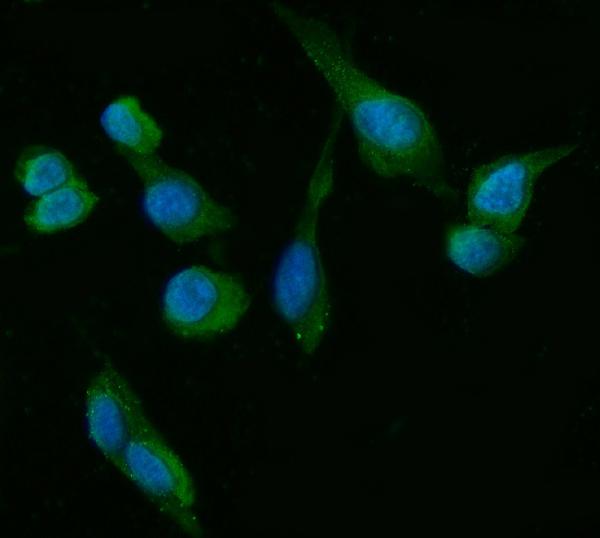 3 - Anti-HSD3B1 Antibody Picoband™ (monoclonal, 3F3C/7F9C8) ABO15108