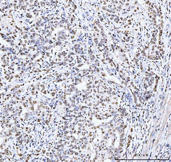 2 - Anti-MCM6 Antibody Picoband™ (monoclonal, 3I4C8) ABO15109