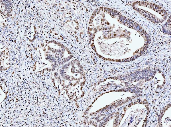 2 - Anti-MCM6 Antibody Picoband™ (monoclonal, 3I4C8) ABO15109