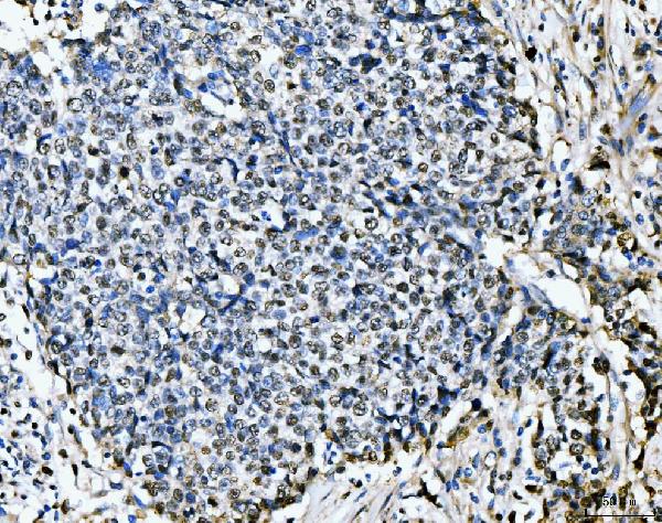2 - Anti-MCM6 Antibody Picoband™ (monoclonal, 3I4C8) ABO15109
