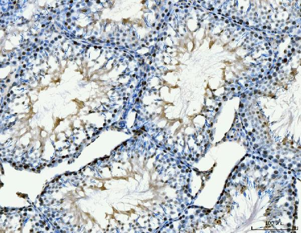 2 - Anti-MCM6 Antibody Picoband™ (monoclonal, 3I4C8) ABO15109