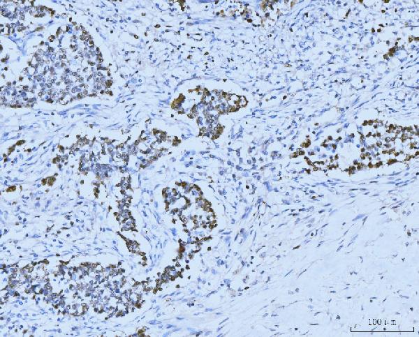 2 - Anti-MCM6 Antibody Picoband™ (monoclonal, 3F13C4) ABO15110