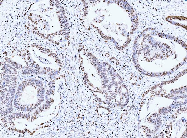 2 - Anti-MCM6 Antibody Picoband™ (monoclonal, 3F13C4) ABO15110
