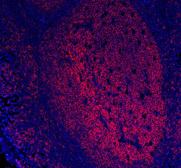 3 - Anti-CD20/MS4A1 Antibody Picoband™ (monoclonal, 4I11) ABO15111