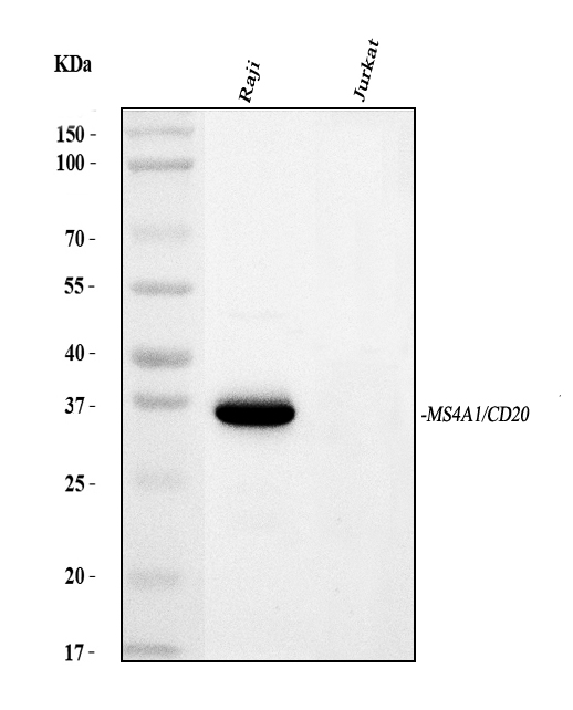 1 - Anti-CD20/MS4A1 Antibody Picoband™ (monoclonal, 4I11) ABO15111