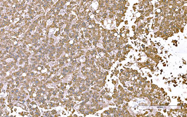 2 - Anti-SND1 Antibody Picoband™ (monoclonal, 5F5E9) ABO15112