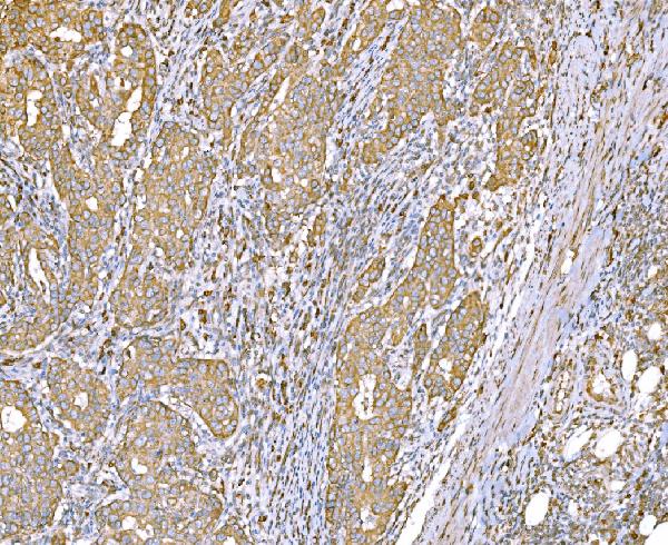 2 - Anti-SND1 Antibody Picoband™ (monoclonal, 5F5E9) ABO15112