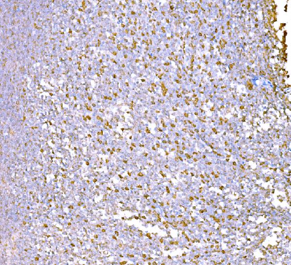 2 - Anti-SND1 Antibody Picoband™ (monoclonal, 5F5E9) ABO15112