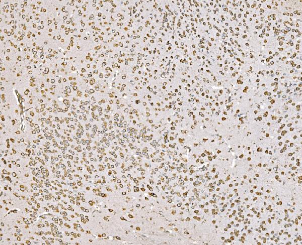 2 - Anti-SND1 Antibody Picoband™ (monoclonal, 5F5E9) ABO15112