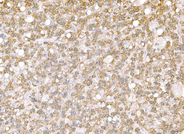 2 - Anti-SND1 Antibody Picoband™ (monoclonal, 6G3B4) ABO15113