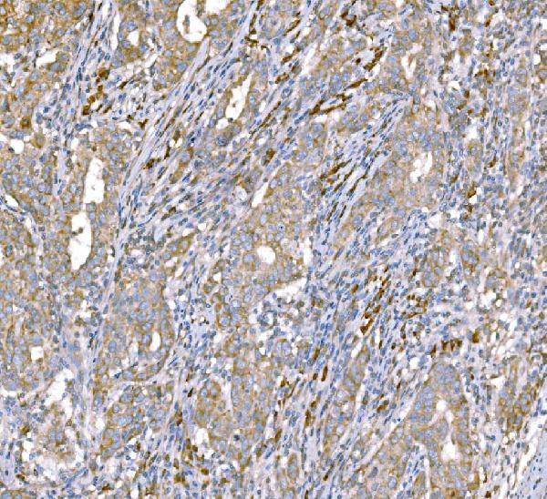 2 - Anti-SND1 Antibody Picoband™ (monoclonal, 6G3B4) ABO15113