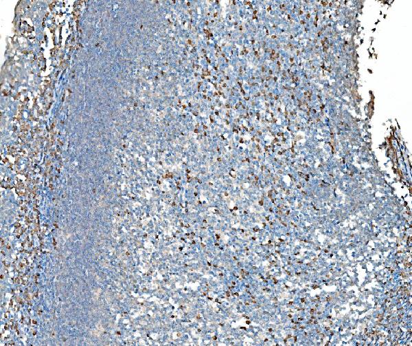 2 - Anti-SND1 Antibody Picoband™ (monoclonal, 6G3B4) ABO15113