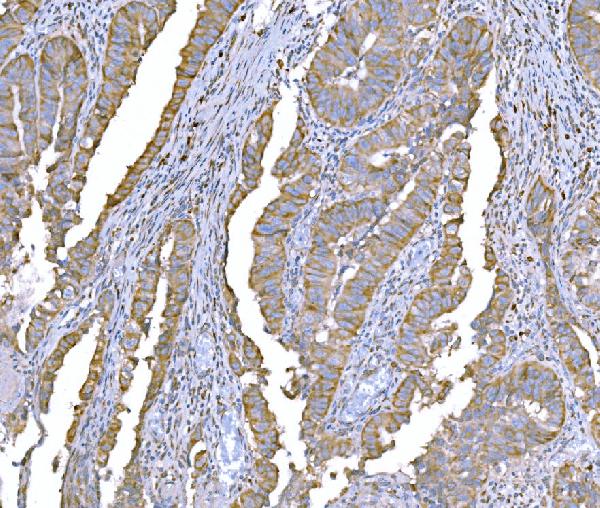 2 - Anti-SND1 Antibody Picoband™ (monoclonal, 6G3B4) ABO15113
