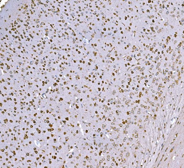 2 - Anti-SND1 Antibody Picoband™ (monoclonal, 6G3B4) ABO15113