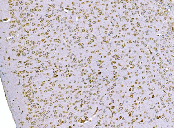 2 - Anti-SND1 Antibody Picoband™ (monoclonal, 6G3B4) ABO15113