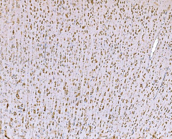 2 - Anti-SND1 Antibody Picoband™ (monoclonal, 6G3B4) ABO15113